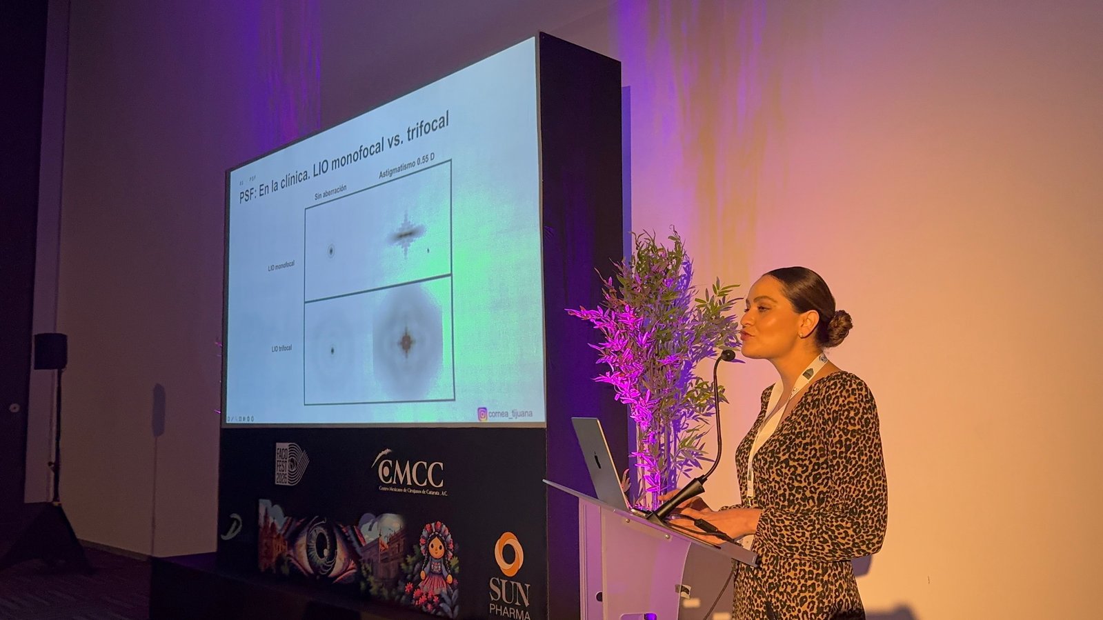 Dr. Ned Davila presenting at FacoFest 2026 on visual quality: monofocal vs. trifocal intraocular lenses