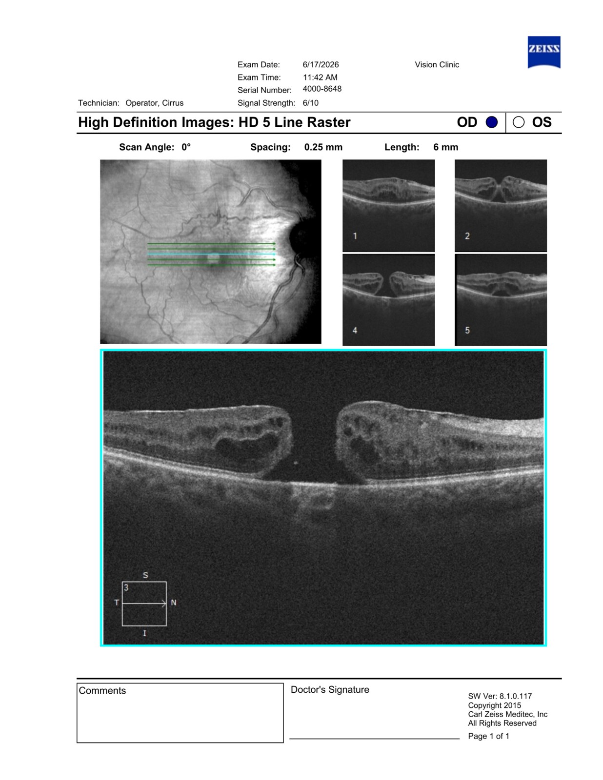 Real example of the study at Vision Clinic