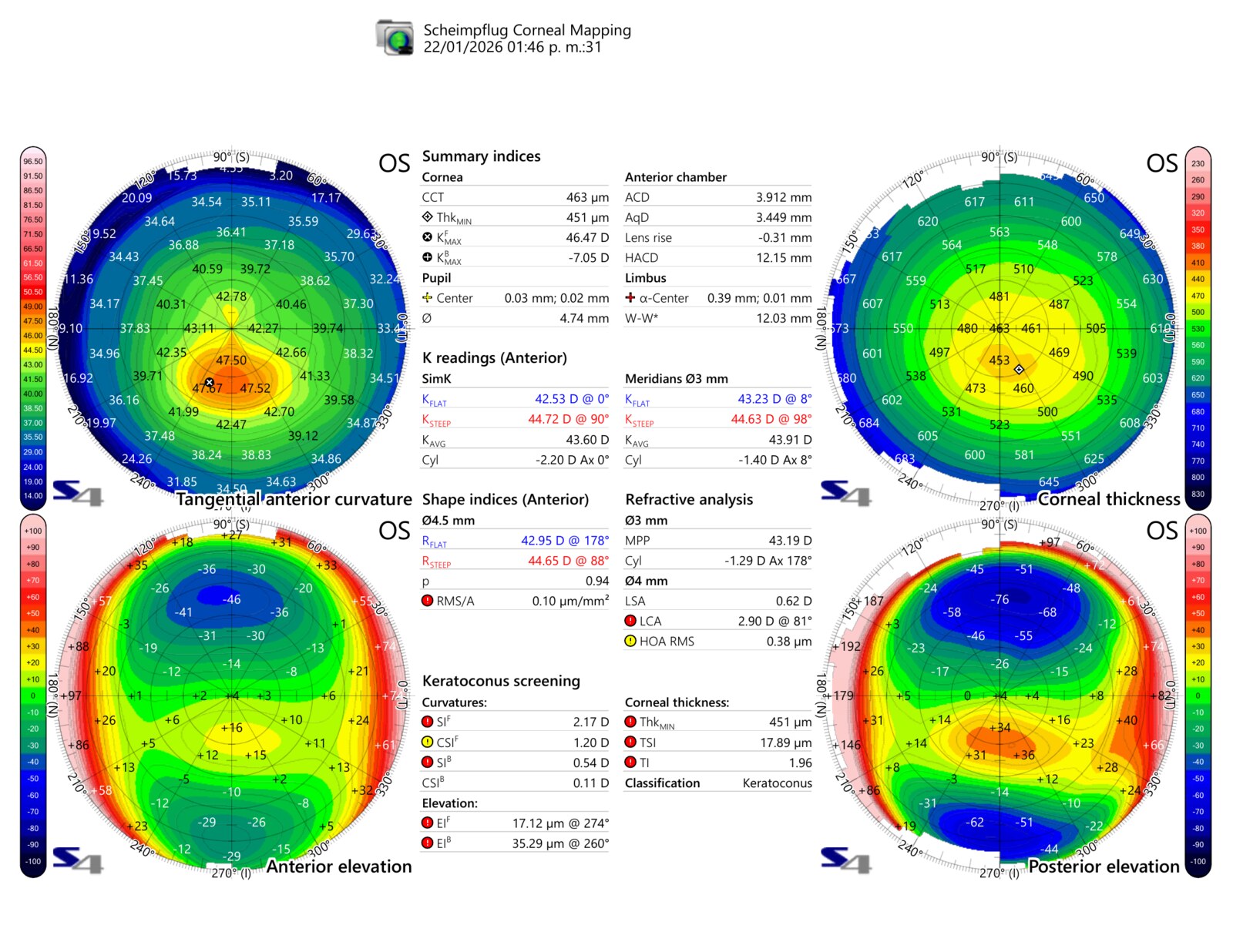 Ejemplo real del estudio en Vision Clinic