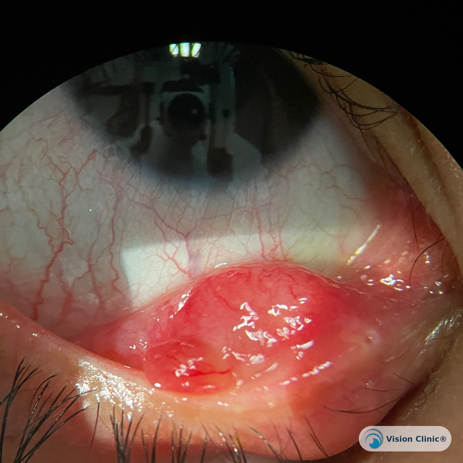 Foto de paciente de Vision Clinic®.