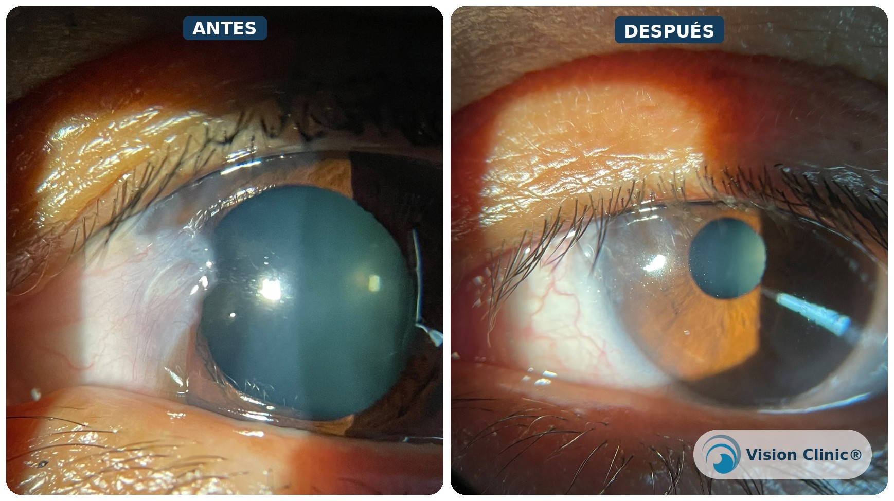 Antes y después