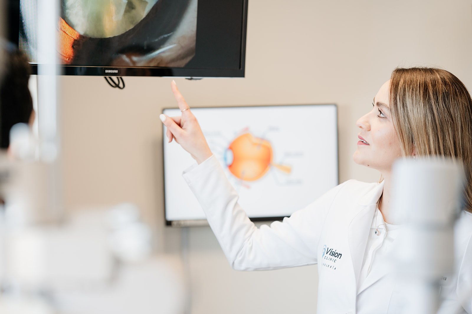 Keratoconus